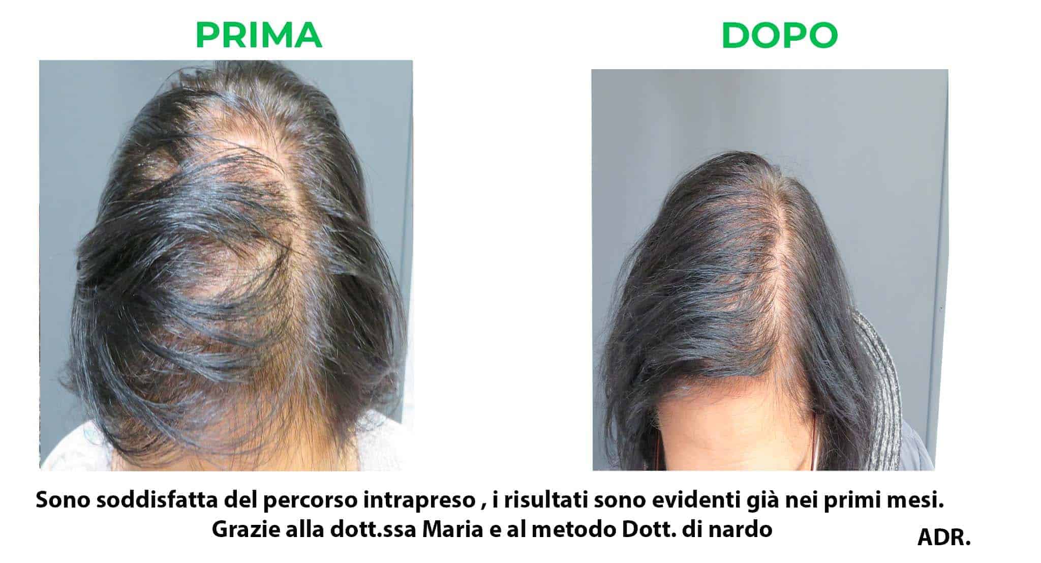 prima_dopo_adr.jpg