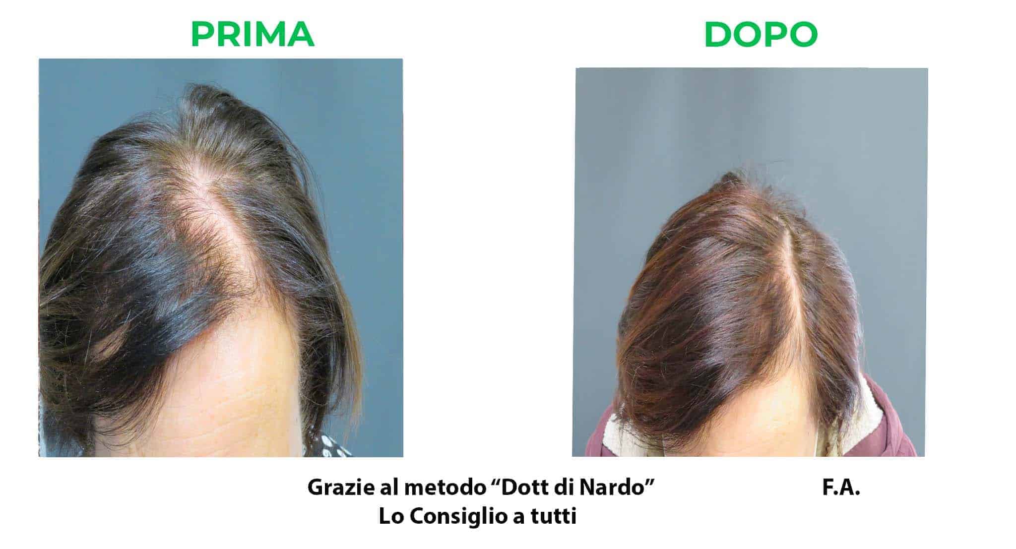 prima_dopo_fa.jpg
