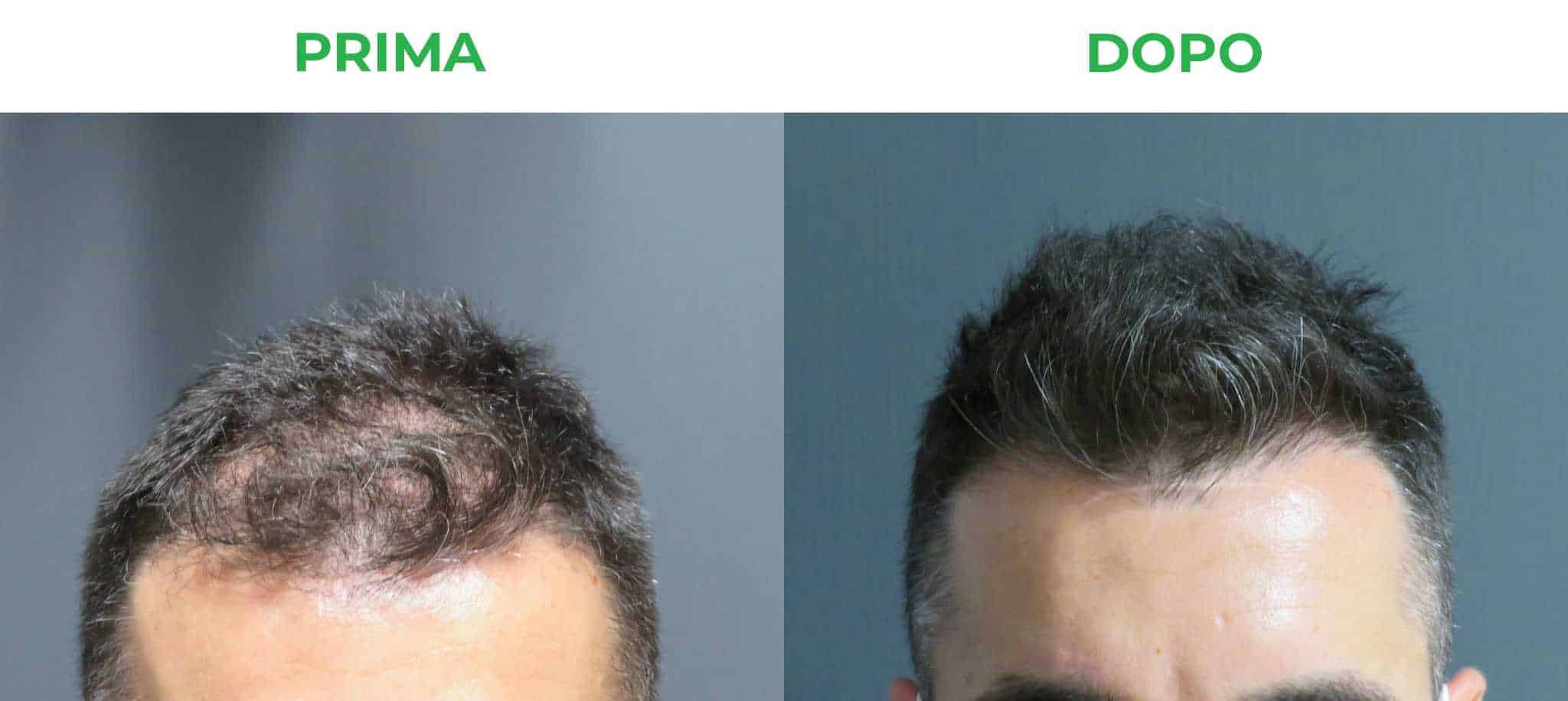 primadopo_1.jpg