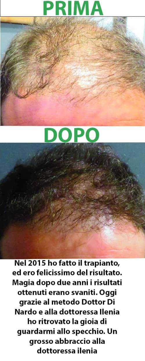primadopo_10_m.jpg