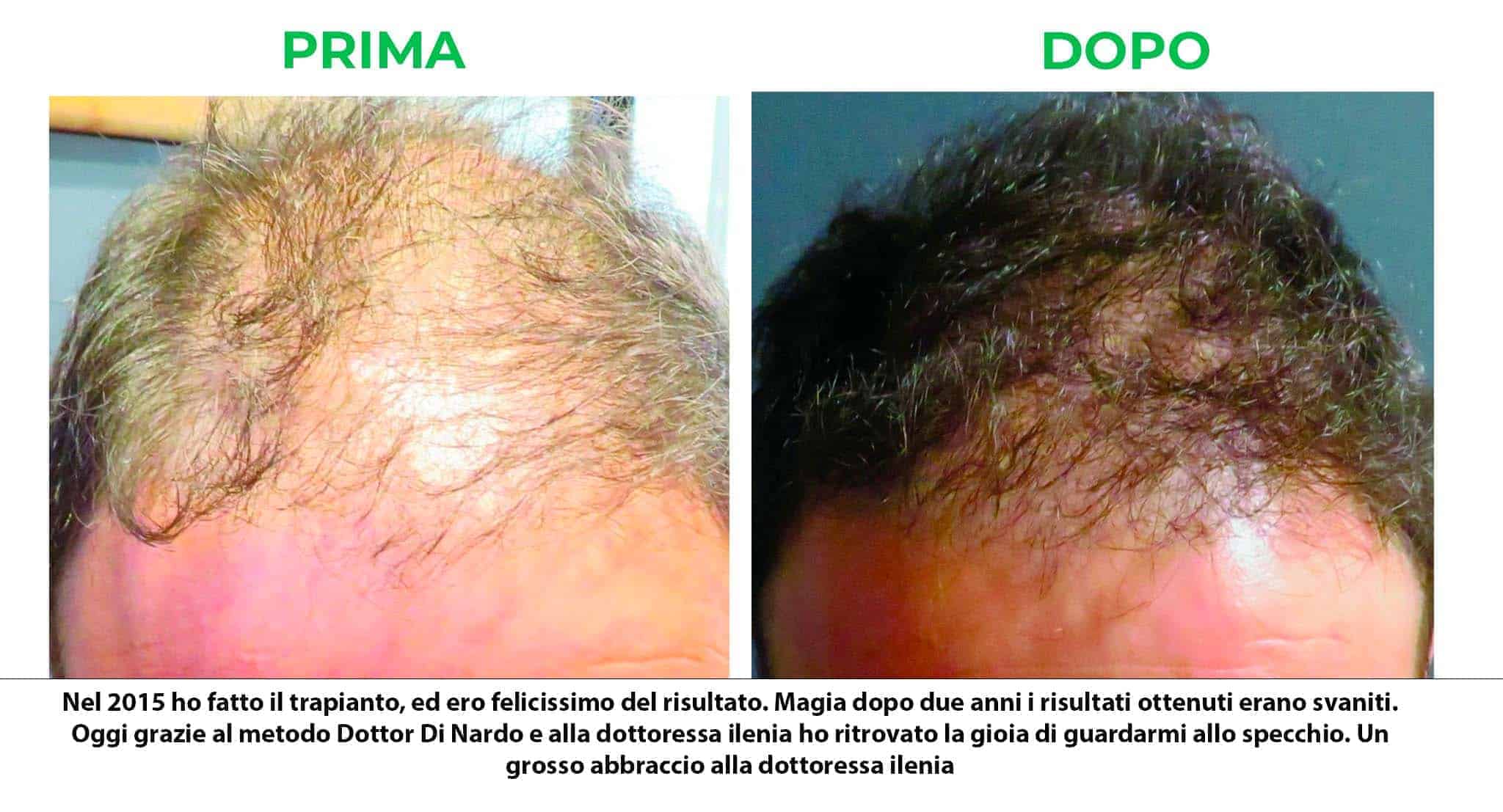 primadopo_10_v2.jpg