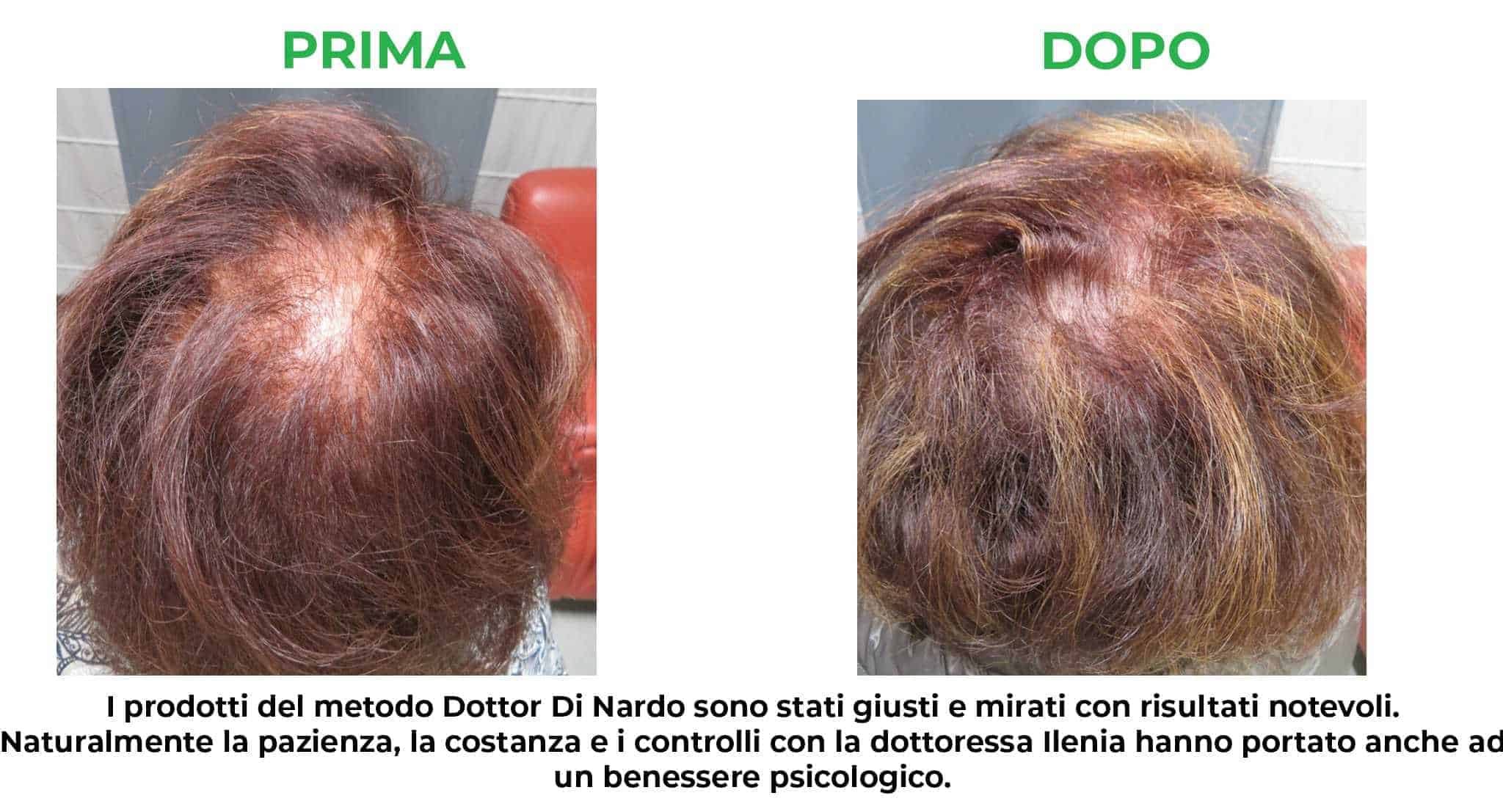primadopo_4.jpg