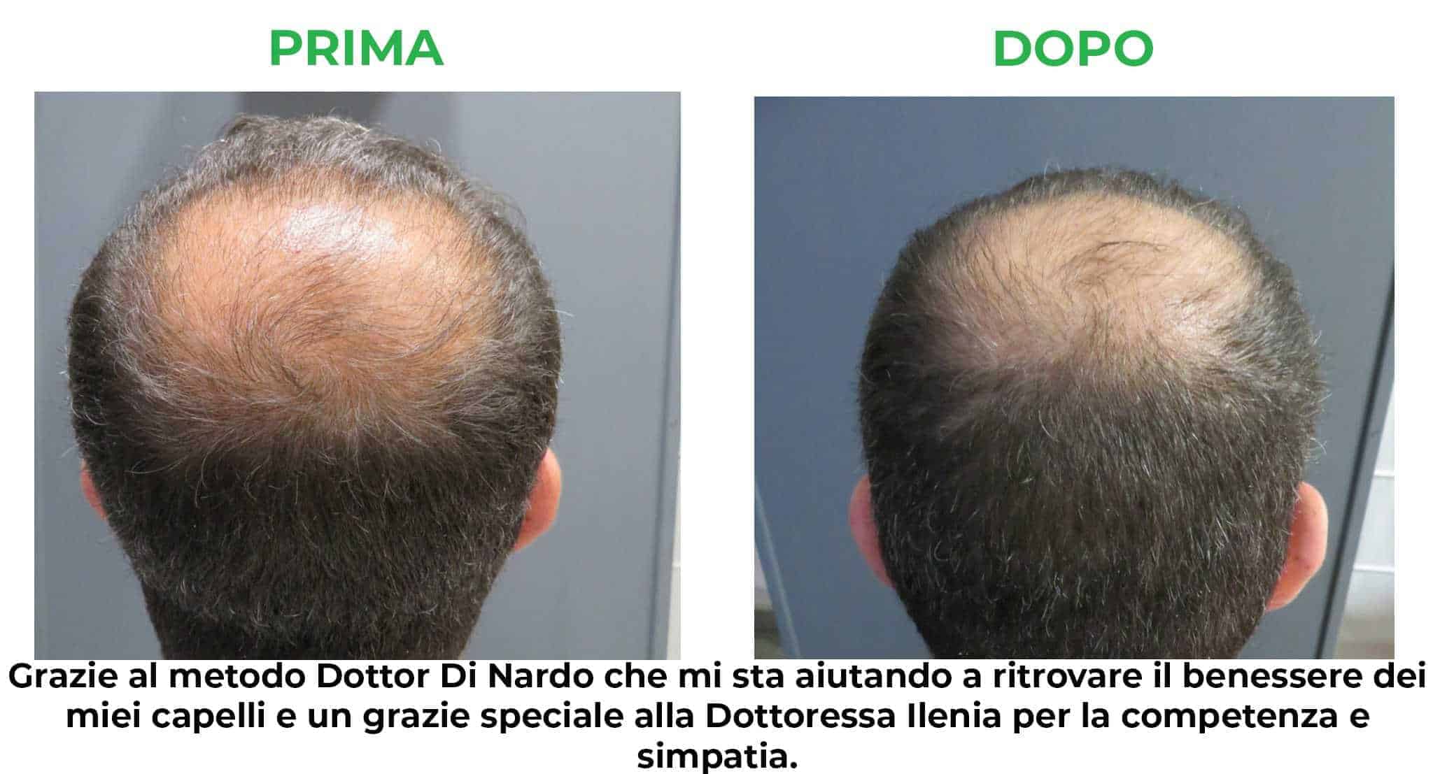 primadopo_5.jpg