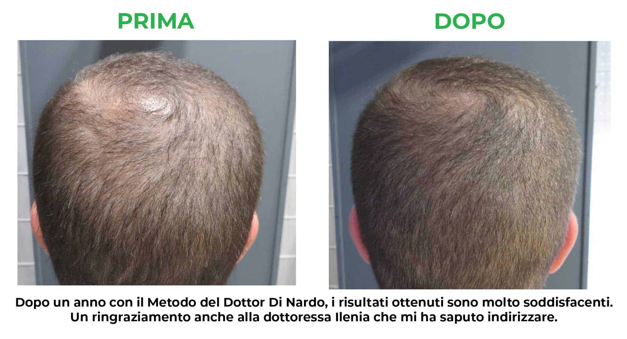 primadopo_8.jpg